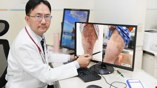 異位性皮膚炎新療法 生物製劑助孩童擺脫長期紅疹與搔癢