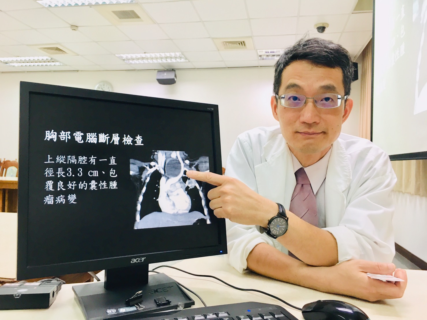 兒童肺炎後喘鳴 竟是胸腔長瘤