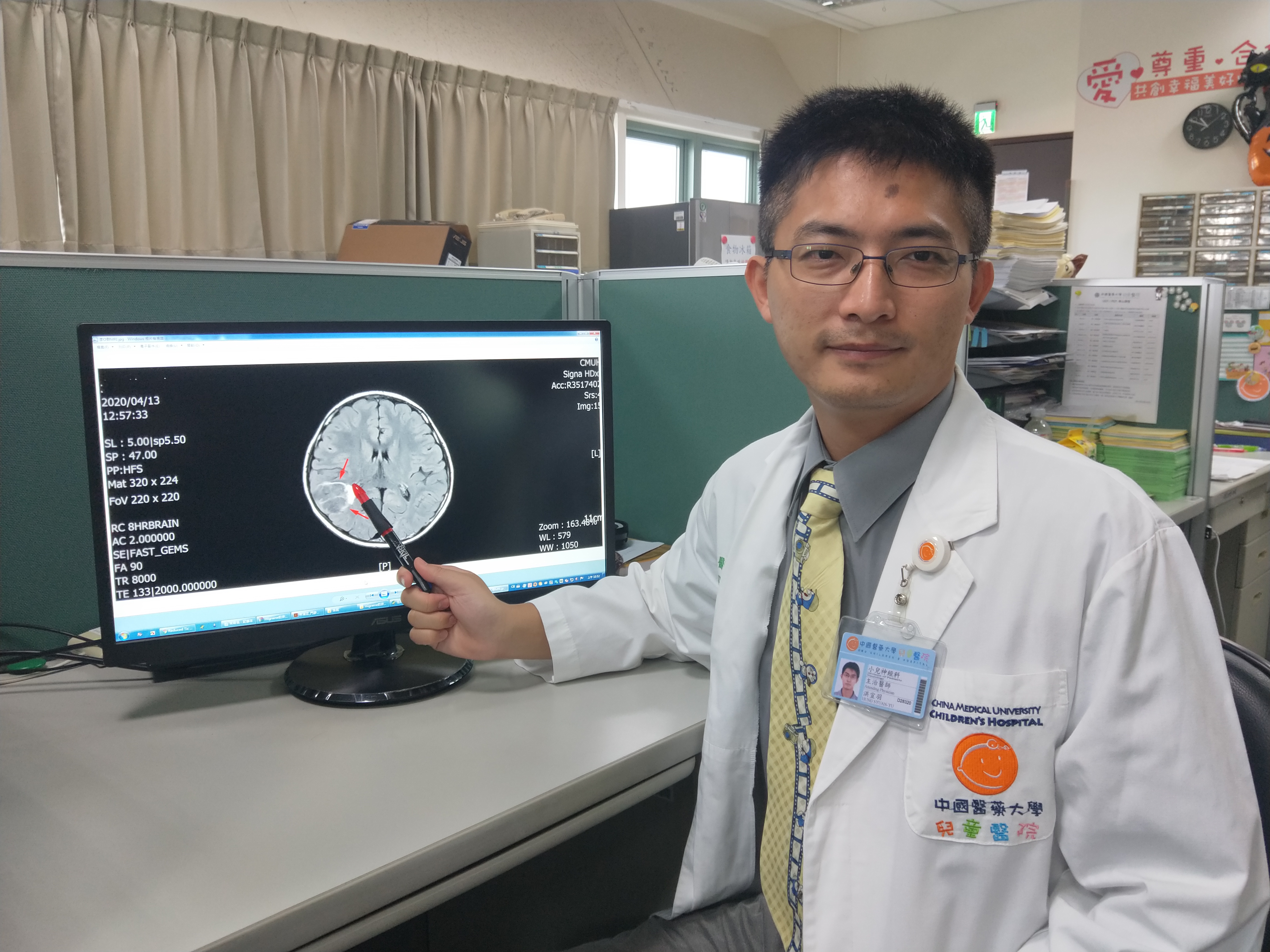 男童中邪?喃喃自語來回漫步,原來是腦瘤引發癲癇發作